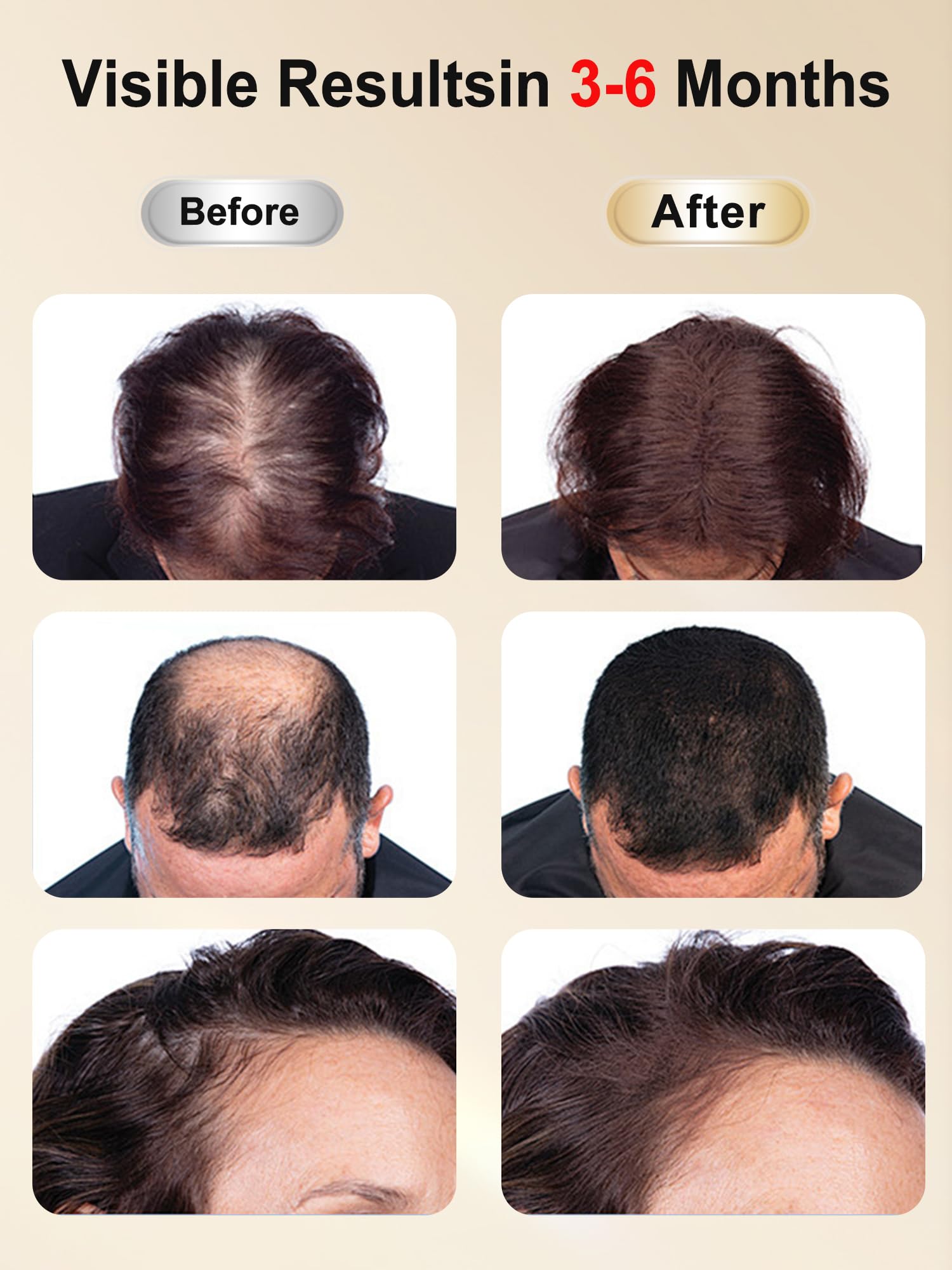 DAWNBOX hair growth cap fabric closeup with soft breathable material