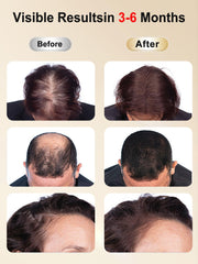 DAWNBOX hair growth cap fabric closeup with soft breathable material