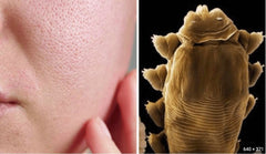 Demodexcillin Skin Solution packaging and label emphasize safety and dermatologist inspired design