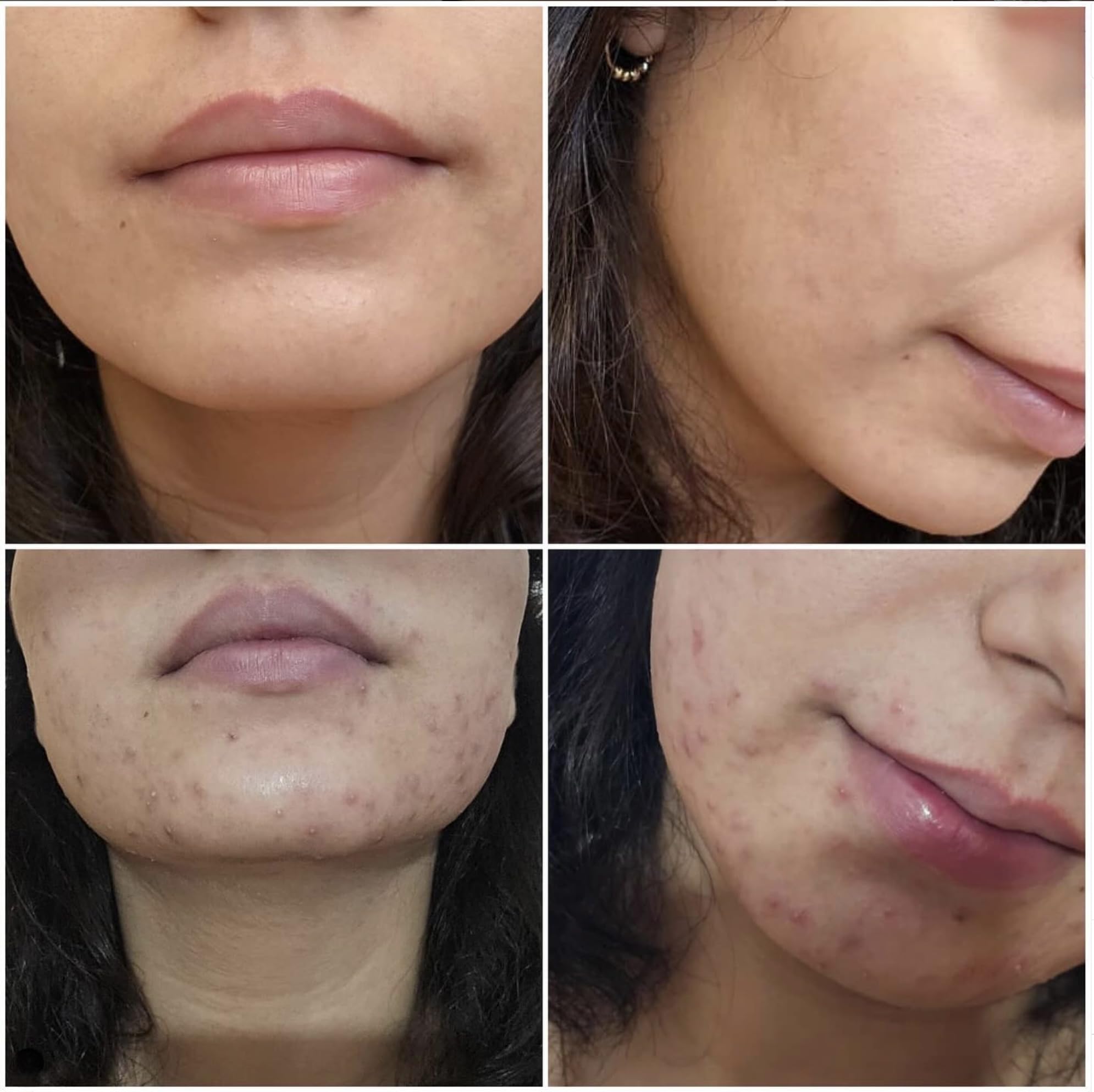 Demodexcillin Skin Solution 4.0 clinical packaging hints at professional grade care