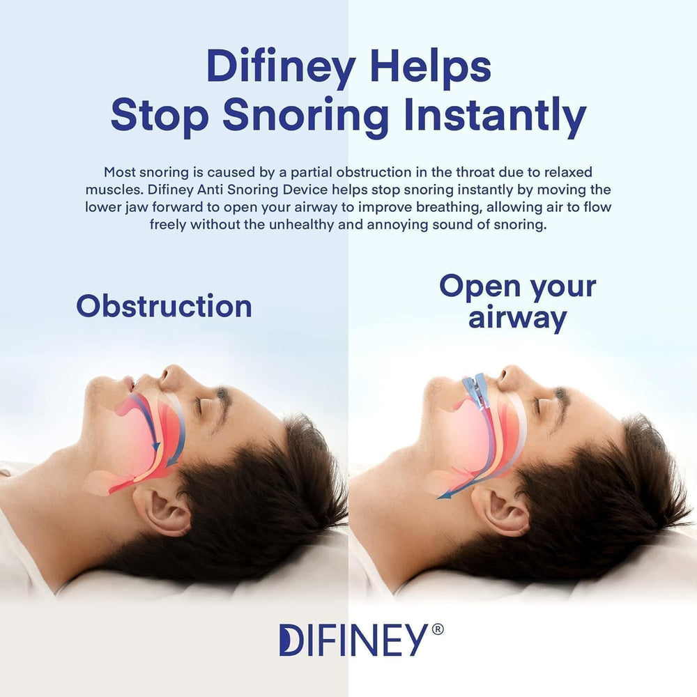 Difiney anti-snoring device moldable-fit demonstrates personalized comfort.