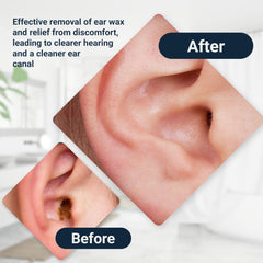 Doctor Easy Elephant Ear Washer one handed operation enables simple control