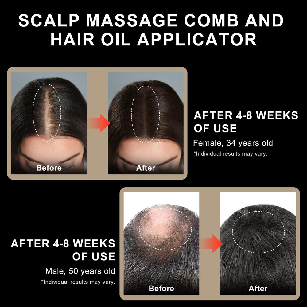 DongBlitz daily scalp cleaning function supports routine hygiene.