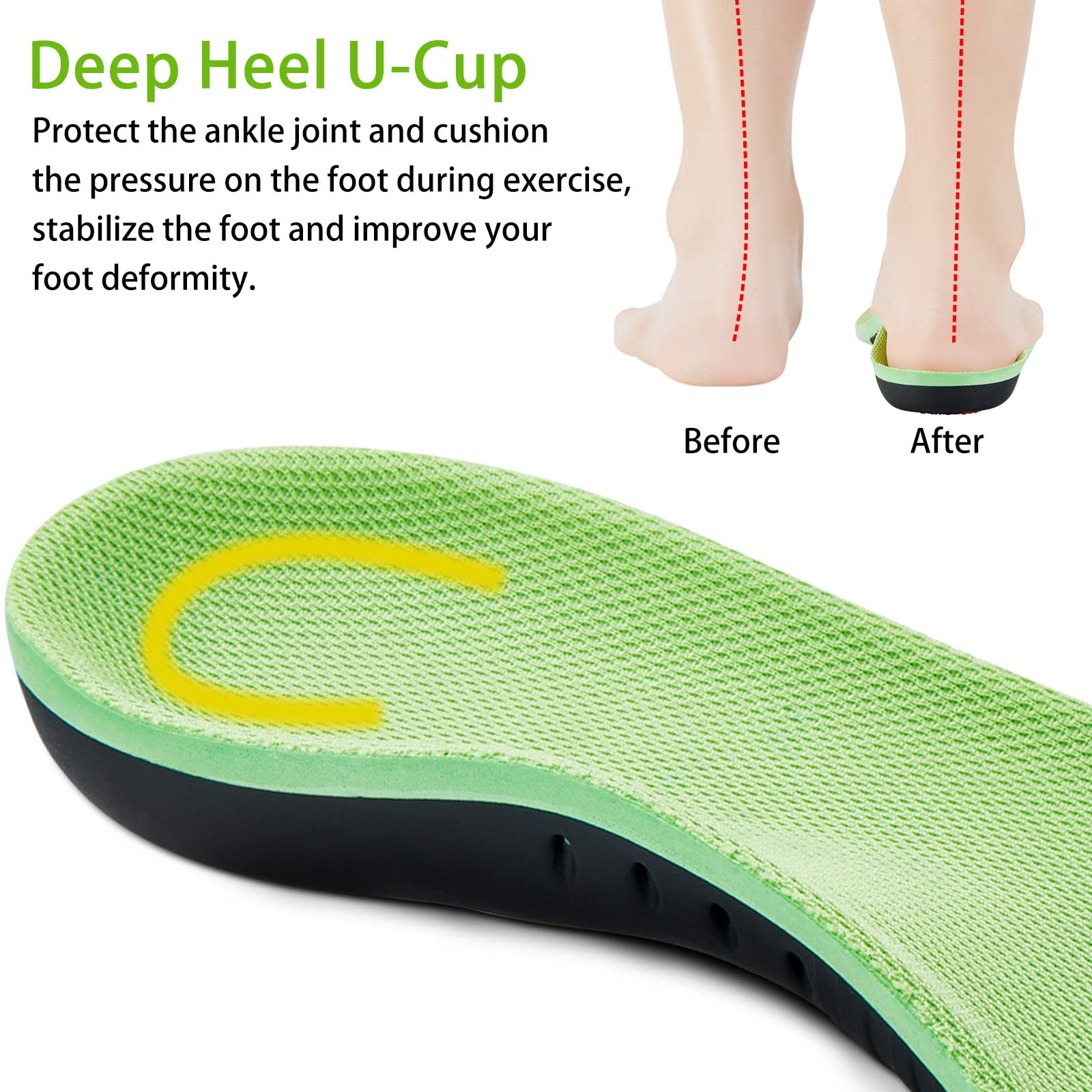 DONQE forefoot-gel-cushion pad for added cushioning