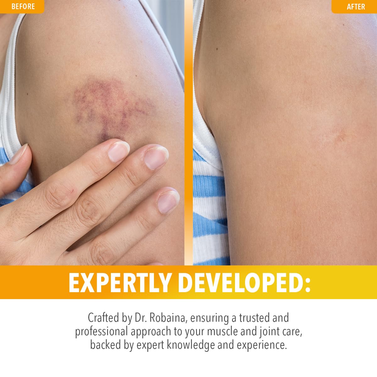 Dr. Robaina Arnica Bruise Roll-On fast-drying formula leaves no sticky residue.