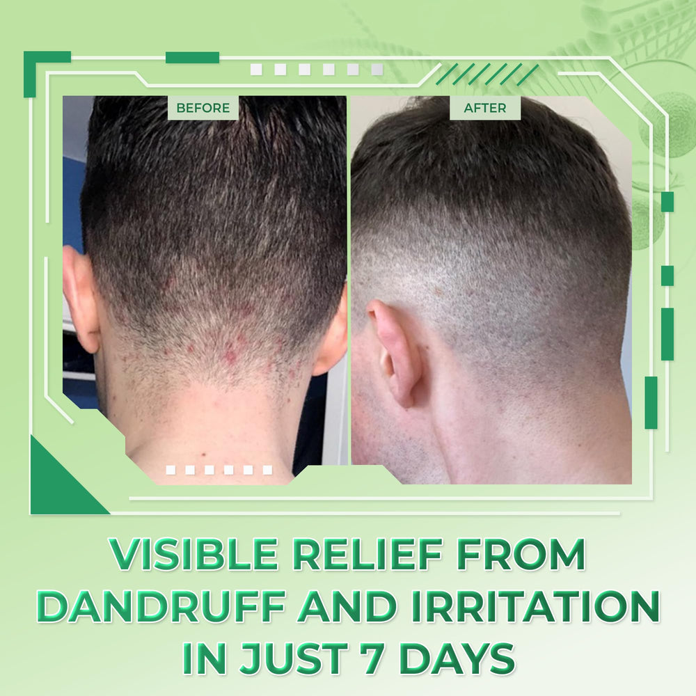 dratoskin shampoo 3pack unboxed presentation emphasizing value and set