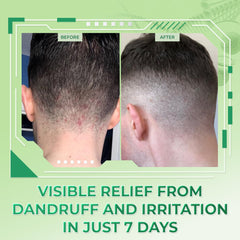 dratoskin shampoo 3pack unboxed presentation emphasizing value and set