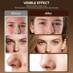 Duuckin eye pads provide protective coverage during treatment sessions.