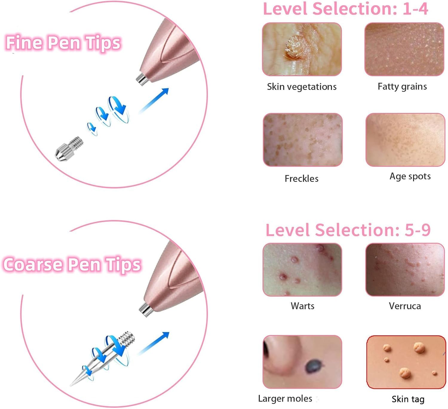 EA269RV Wart and Skin Tag Remover Pen LCD display shows adjustable intensity