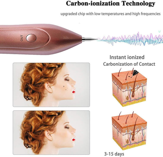 EA269RV Wart and Skin Tag Remover Pen nine precision tips for targeted treatment