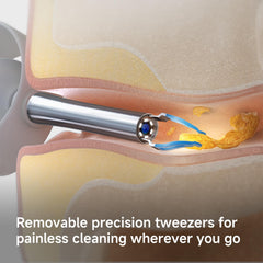 ECCLEUTH pain‑free tweezers at 15 degrees minimize contact