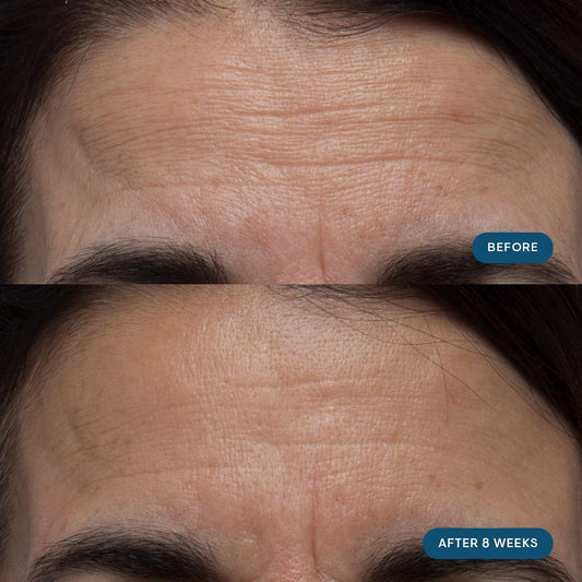 ELEMIS Pro-Collagen Skin Future capsules in focus, illustrating daily use.