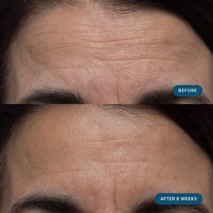 ELEMIS Pro-Collagen Skin Future capsules in focus, illustrating daily use.