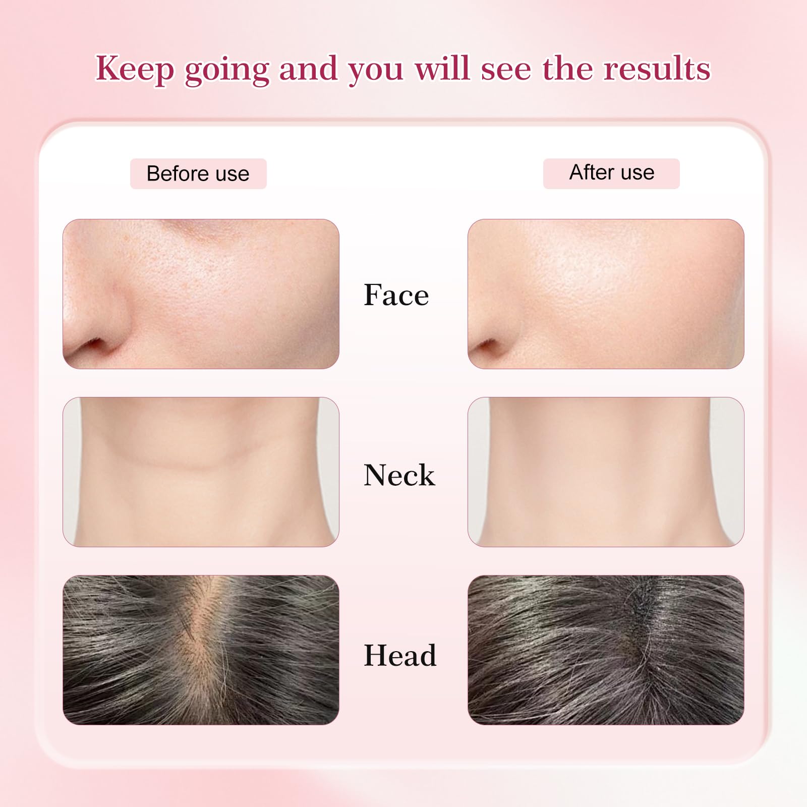 Erdnretl portable rechargeable design for on-the-go skincare