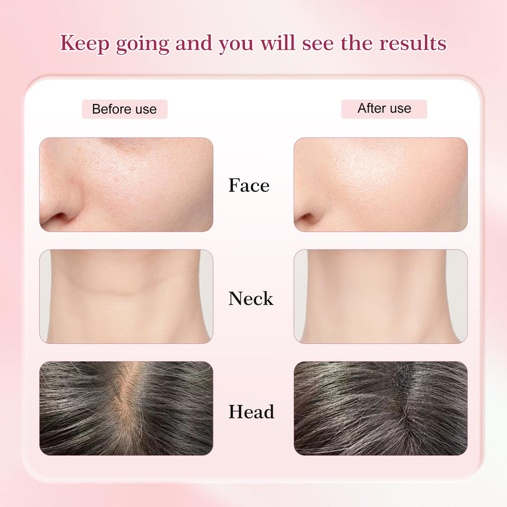 Erdnretl portable rechargeable design for on-the-go skincare