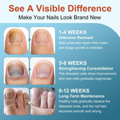 ERWCNMIE damaged nails before and after care visualization