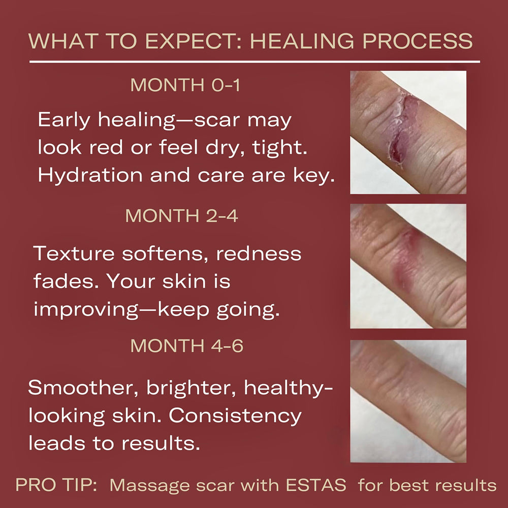 Three-product scar care kit shown with guidance for daily use.