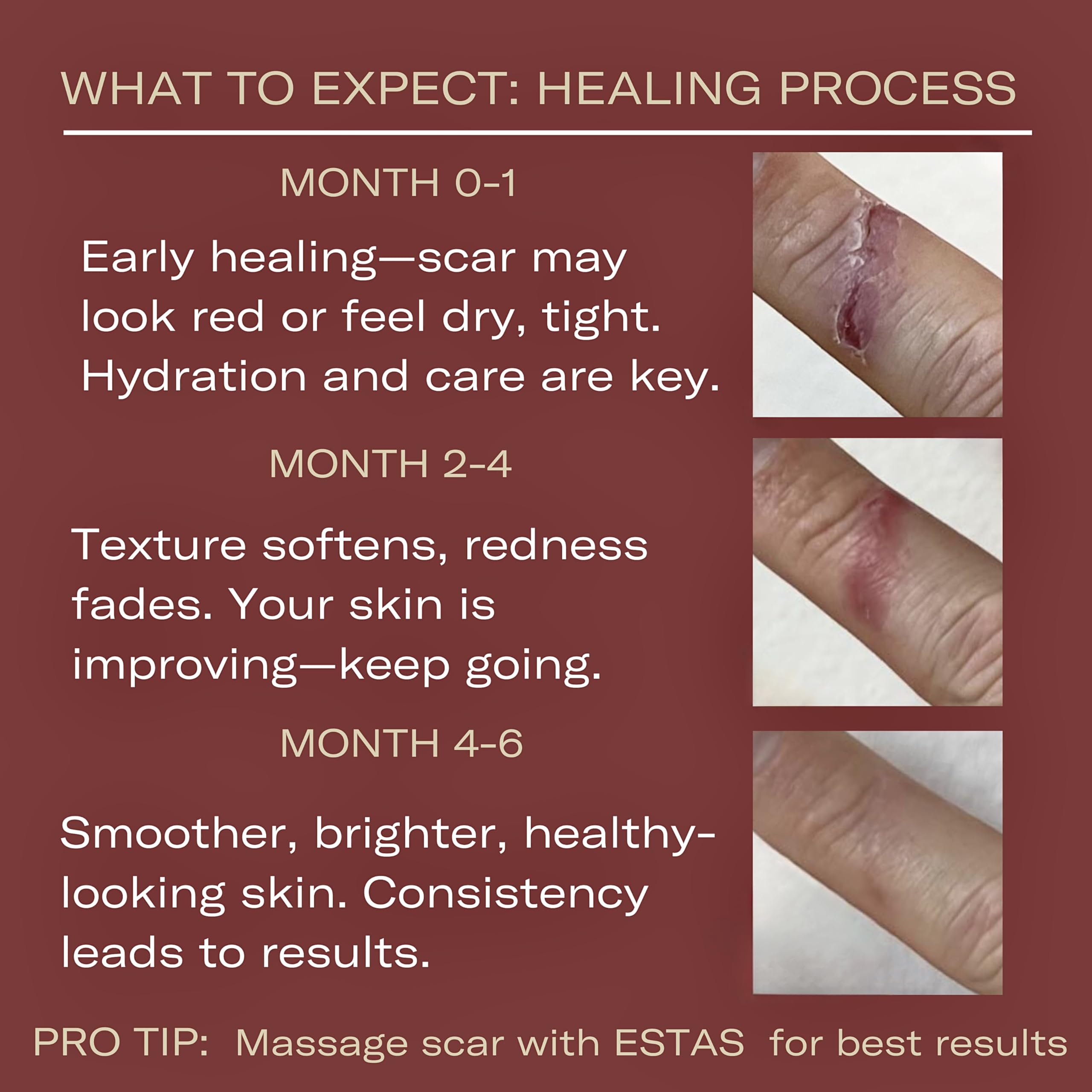 ESTAS Beauty Scar Cream applying formula on skin for scar care.