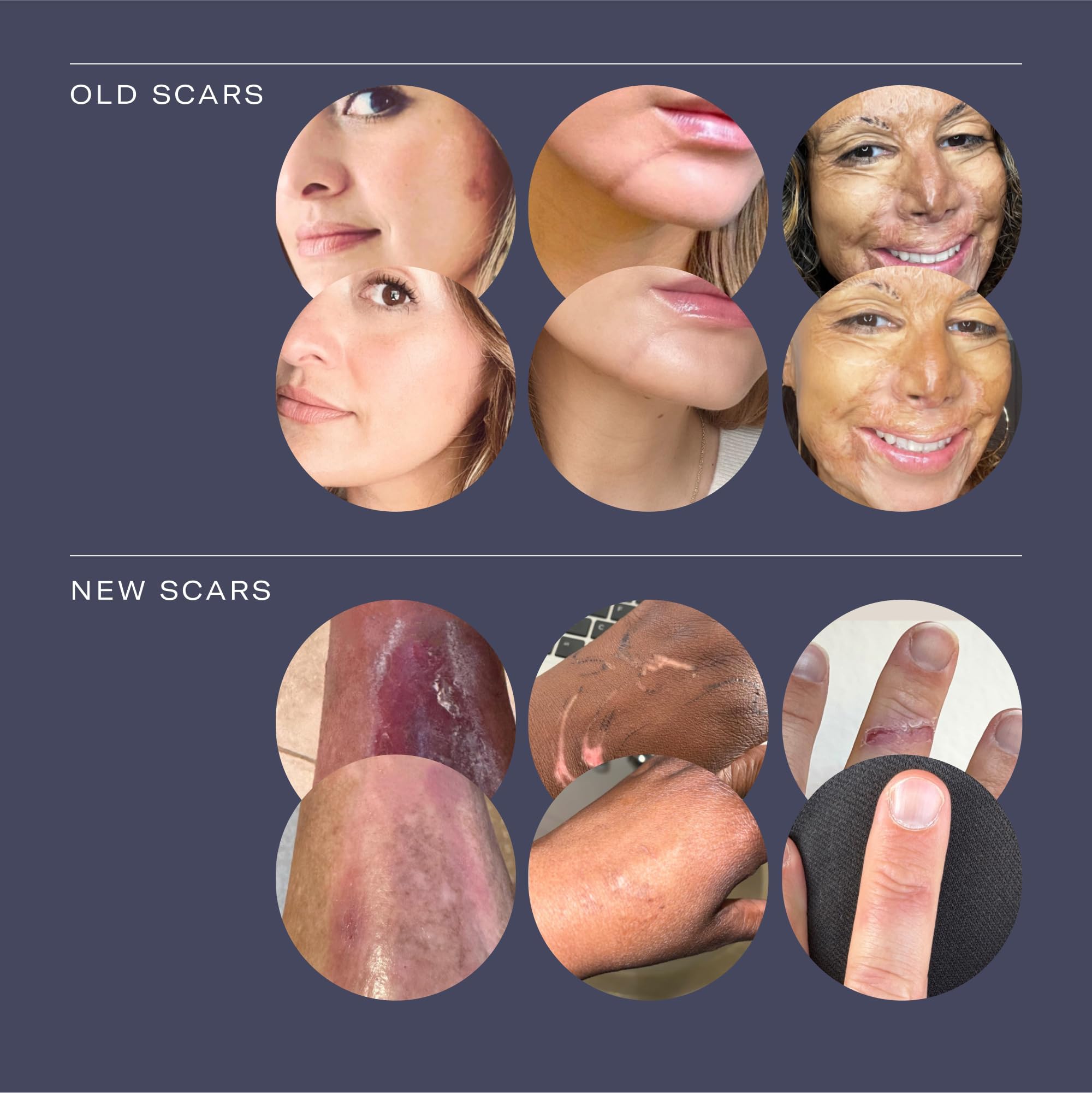 ESTAS Beauty Scar Cream silicone barrier locks in moisture on skin.