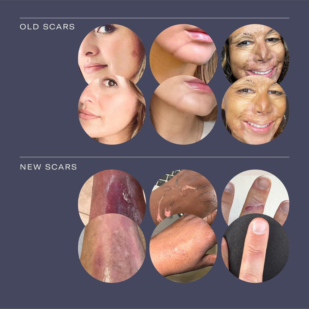ESTAS Beauty Scar Cream silicone barrier locks in moisture on skin.