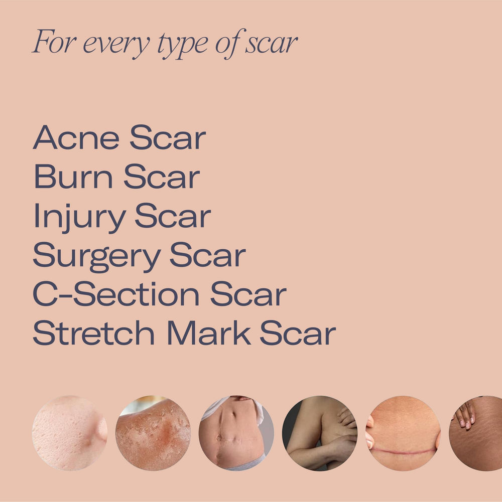 ESTAS Beauty Scar Cream ingredients Vitamin E and C highlighted.