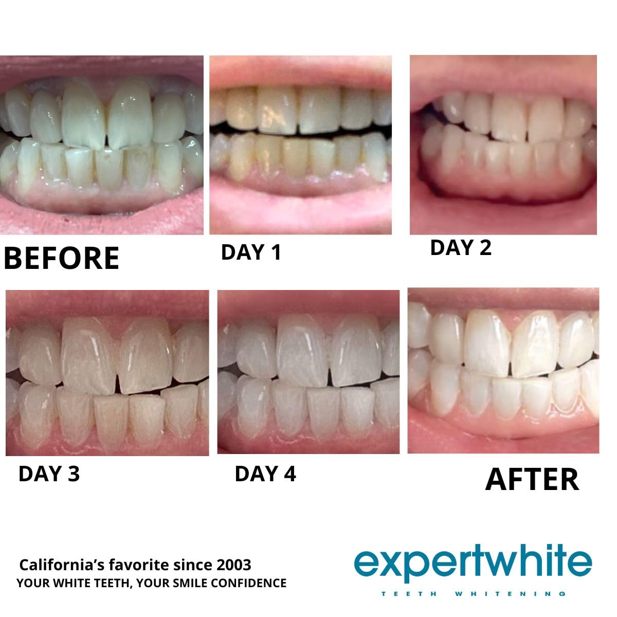 Expertwhite made in USA badge on packaging signals quality and safety.