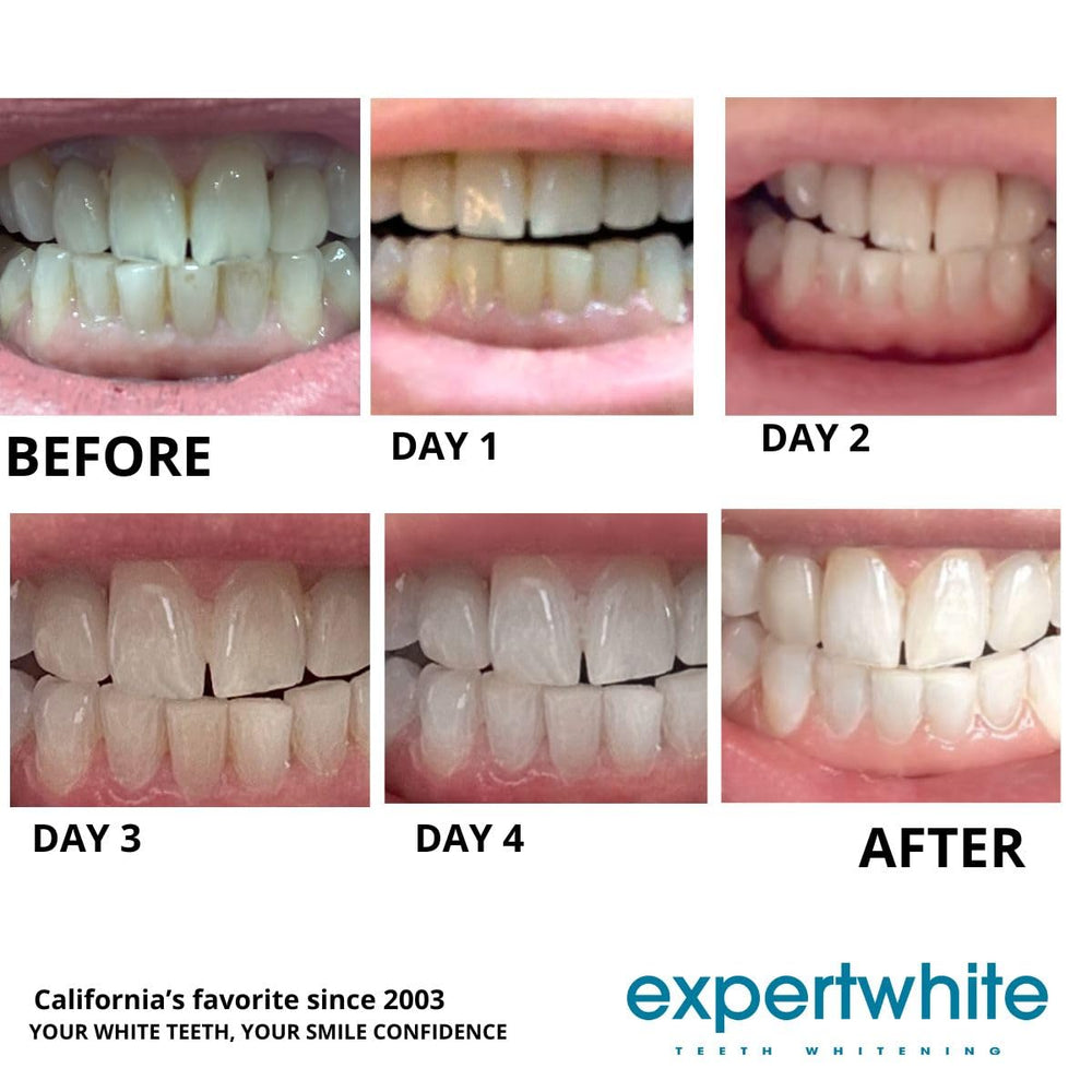 Expertwhite made in USA badge on packaging signals quality and safety.