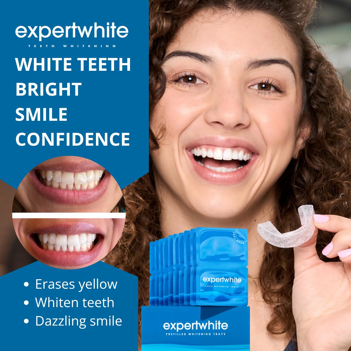 ExpertWhite Max Glow Trays dry-gel activation demonstrates quick, even whitening.