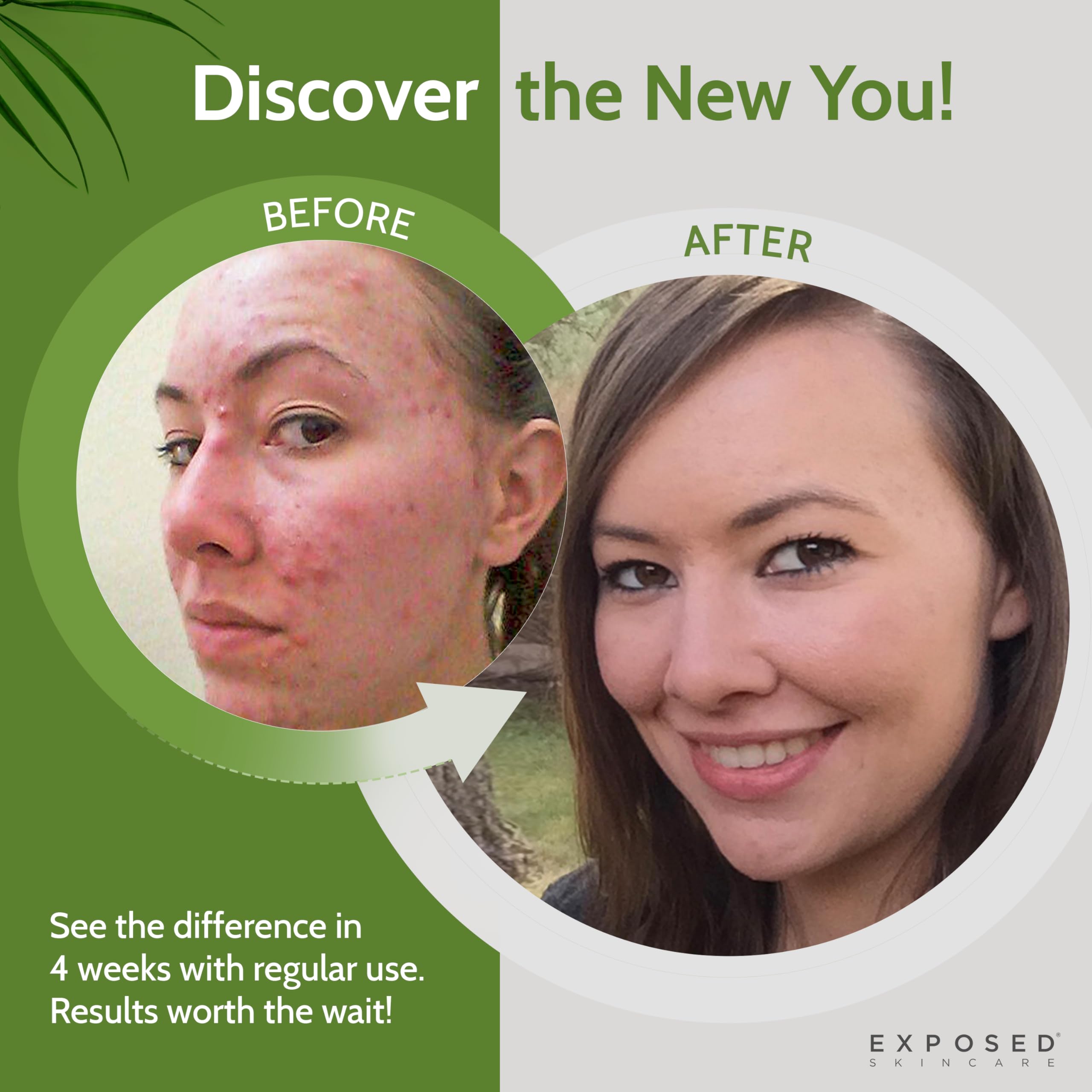Exposed Skin Care ingredient list with minerals and vitamins for overall wellness.