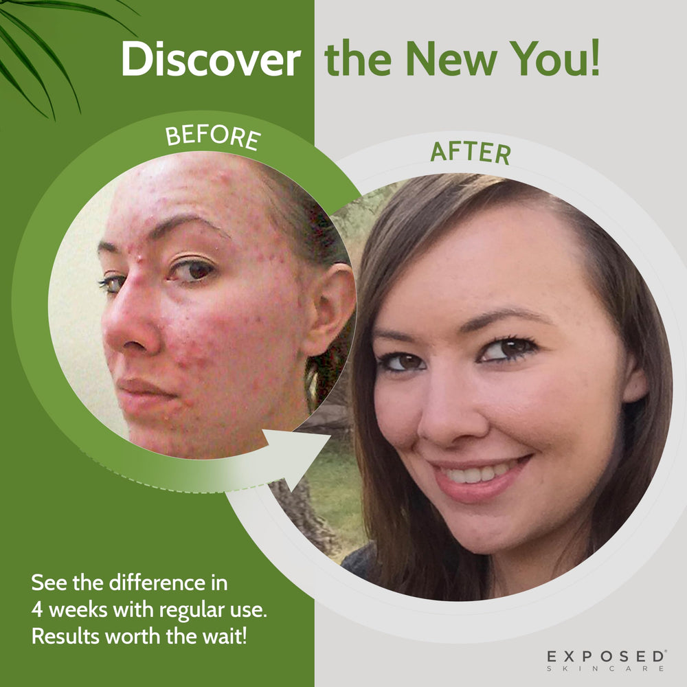 Exposed Skin Care ingredient list with minerals and vitamins for overall wellness.