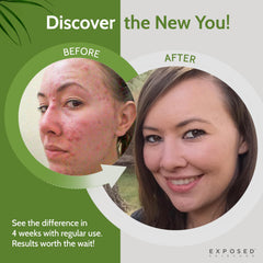 Exposed Skin Care ingredient list with minerals and vitamins for overall wellness.