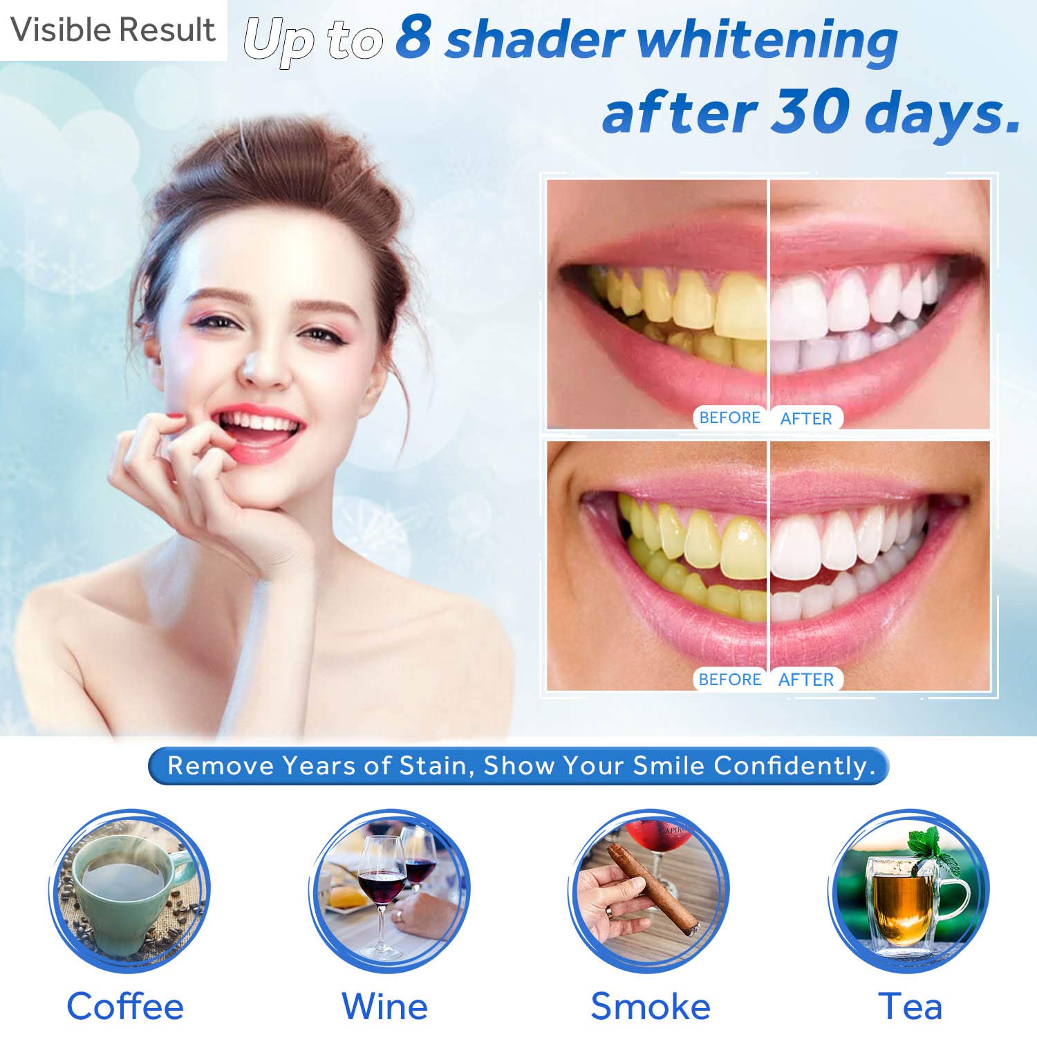EZGO gel dispensing tips enabling precise application for consistent whitening.
