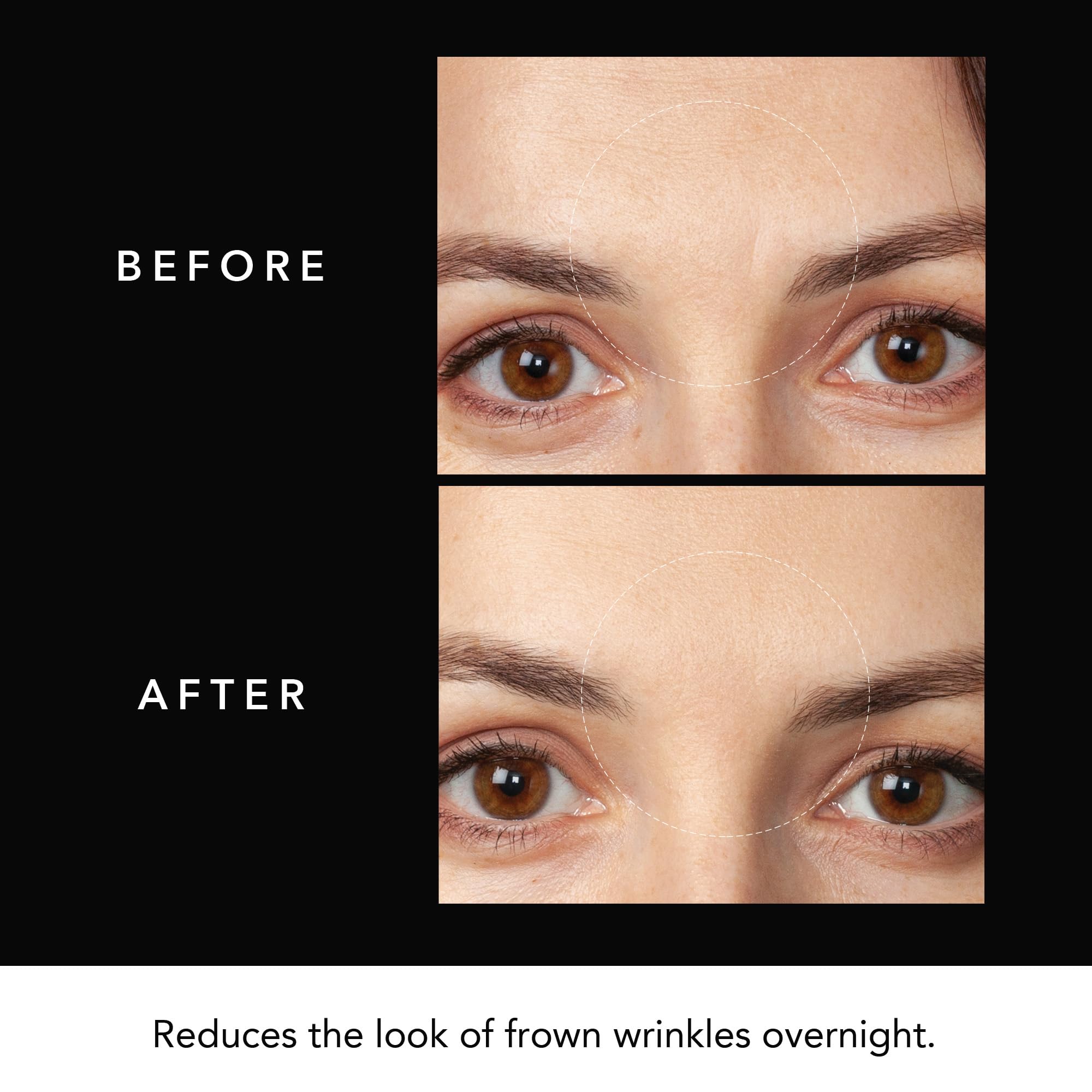 FAQ Nighttime skincare routine with Forehead Patches for overnight use.