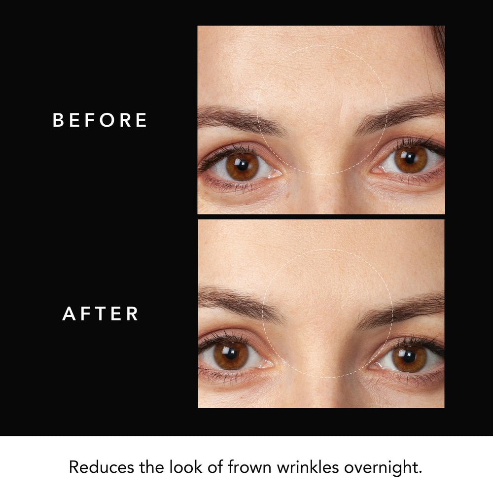 FAQ Nighttime skincare routine with Forehead Patches for overnight use.
