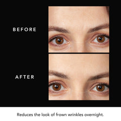 FAQ Nighttime skincare routine with Forehead Patches for overnight use.