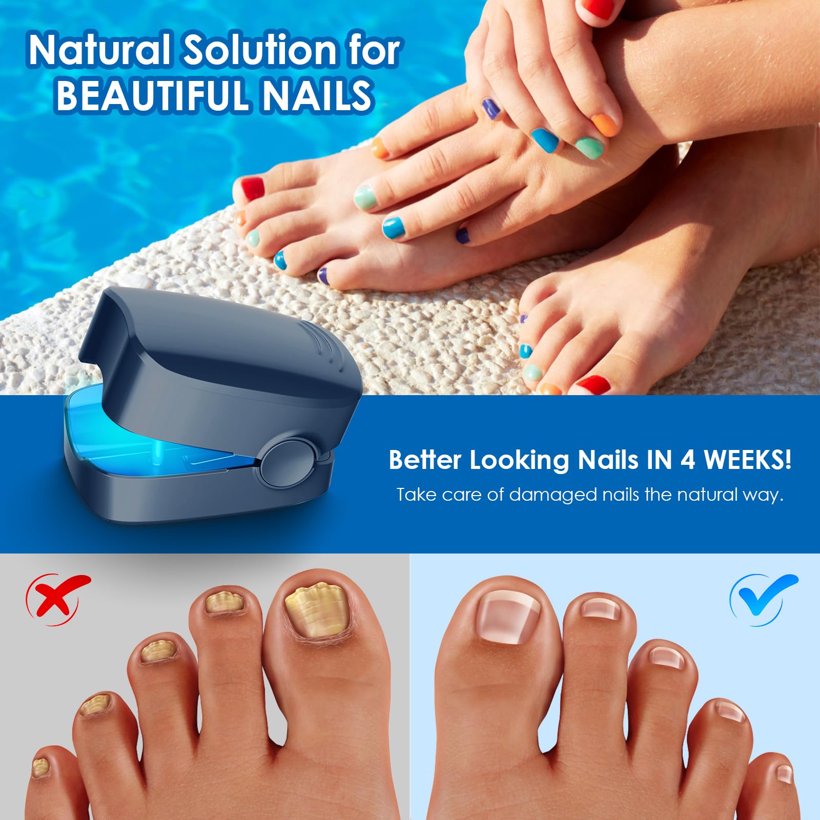 FEIGOMA handheld nail fungus device enabling easy home use and consistent treatment