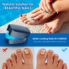 FEIGOMA handheld nail fungus device enabling easy home use and consistent treatment