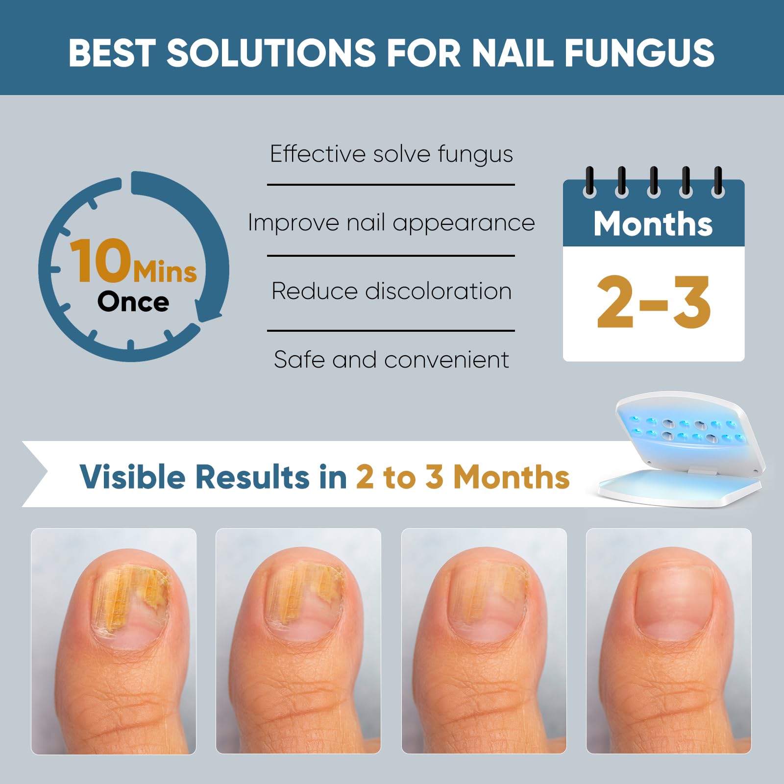 FEIGOMA Nail Fungus Light Device control panel for simple timing