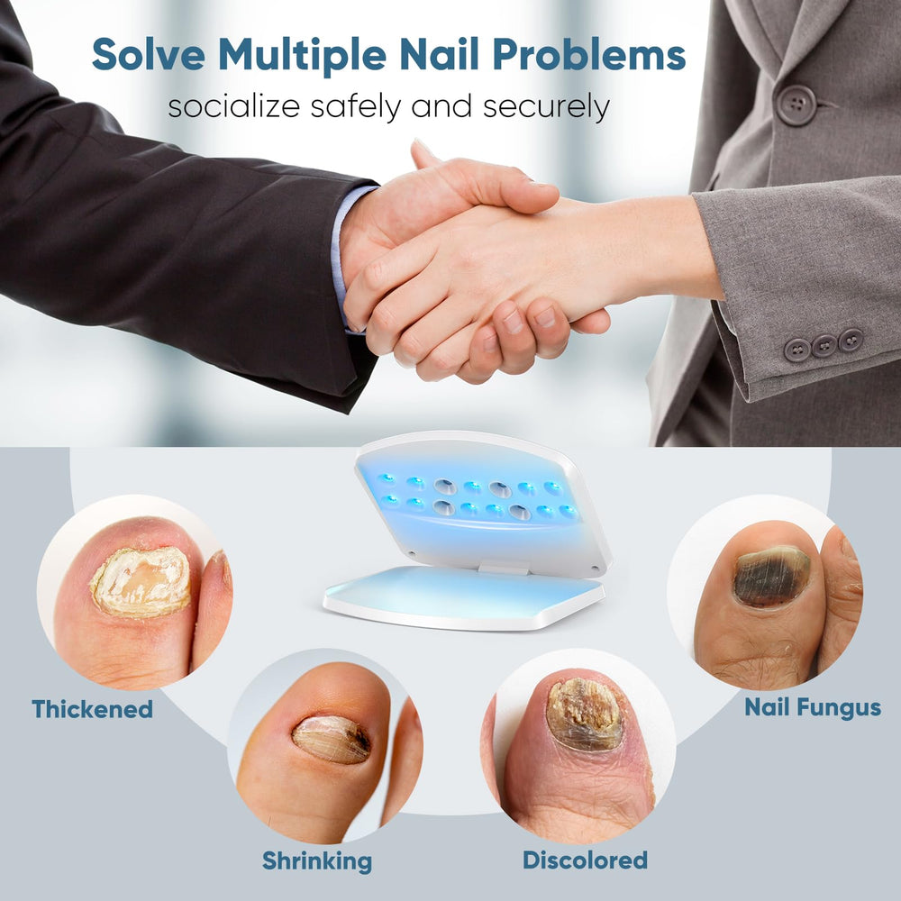 FEIGOMA Nail Fungus Light Device foot inside for toenail care