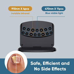 FEIGOMA device in use on hand for safe home treatment