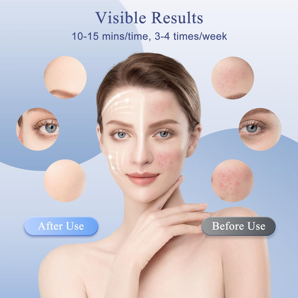 Fiogeo soft silicone mask provides comfortable wear during use