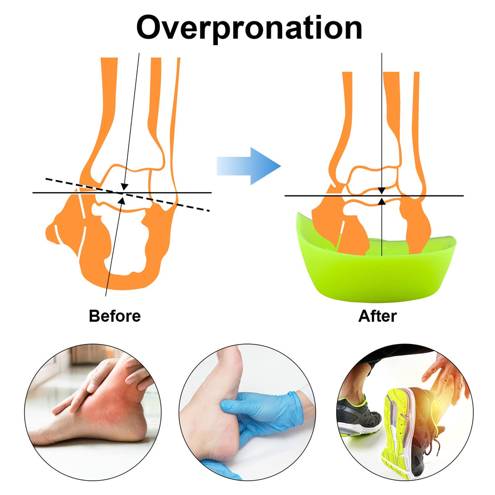 FiotSkep orthotic insole in running shoe demonstrating everyday use