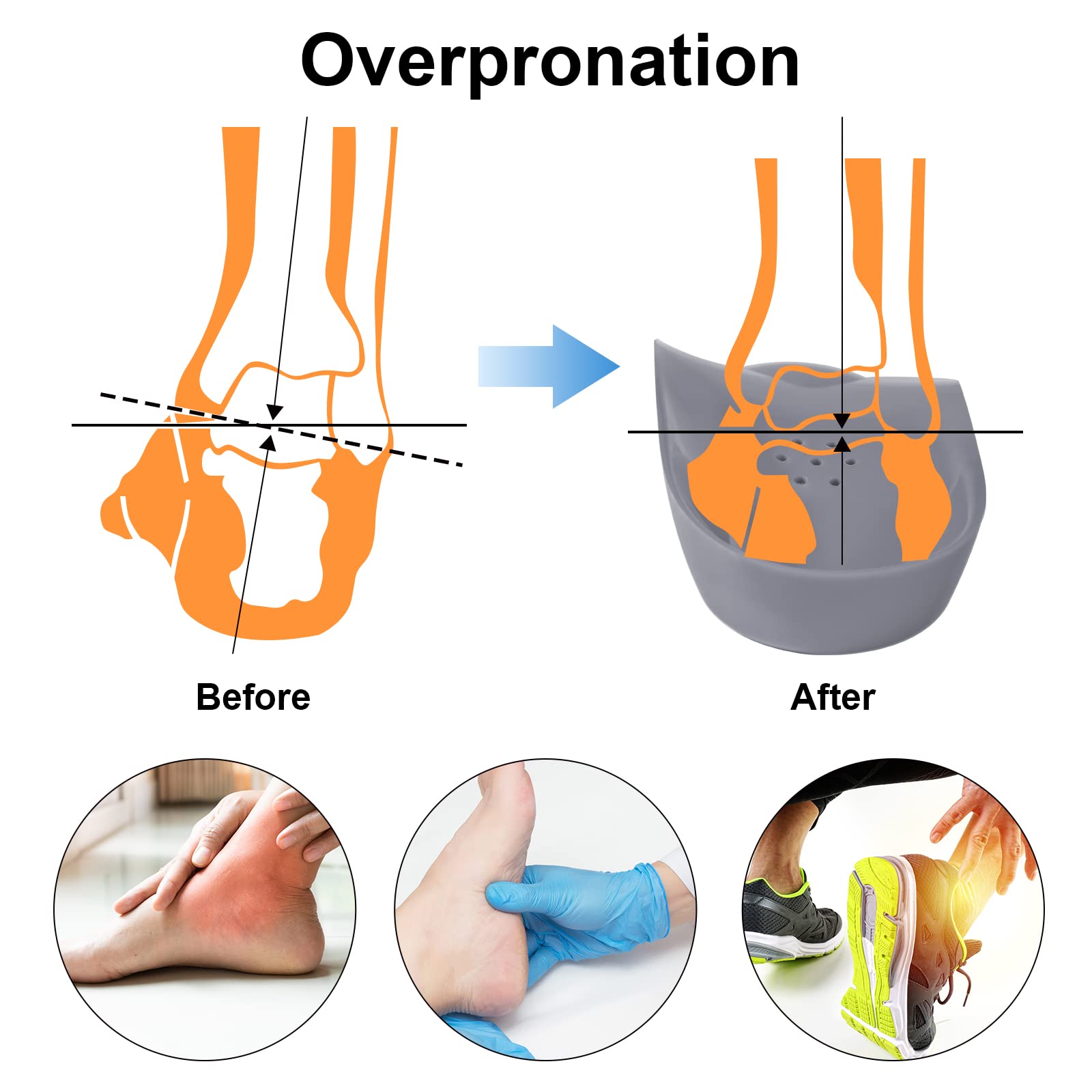 FiotSkep inserts help many users feel more stable and comfortable throughout the day.