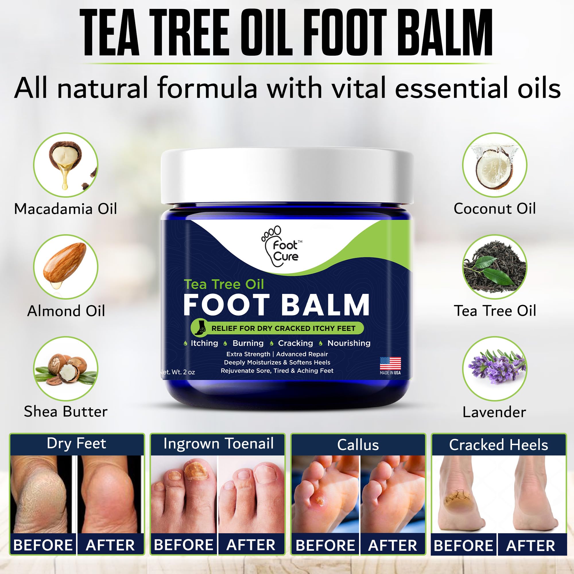 Soft, smoother feet after regular use of FOOT CURE balm