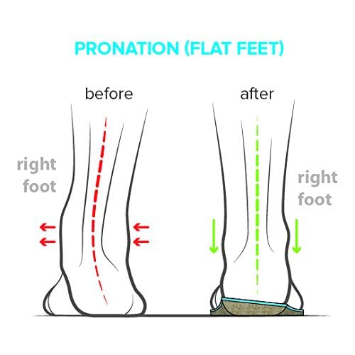 FootScientific Arches Type 1 EVA comfort layer adds ongoing shock absorption.