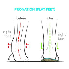 FootScientific Arches Type 1 EVA foam comfort layer absorbs shock over time