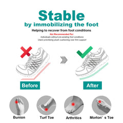 Freeior carbon fiber insole, side profile, lightweight stability during recovery.