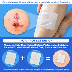 FRESINIDER sterile, individually wrapped dressings ready for travel
