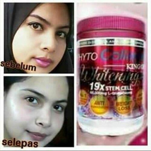 FSM Phyto Collagen Whitening 19X Stem Cell capsules inside indicate convenient daily supplementation.