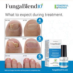 FungaBlend 10 plant medicines blend shown as natural therapy for nails.
